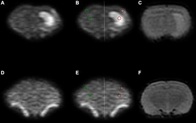 Heterogeneity evaluation of multi-high b-value apparent diffusion coefficient on cerebral ischemia in MCAO rat